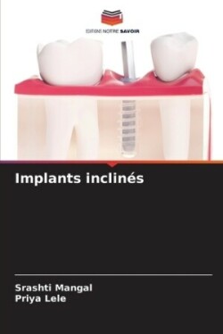 Implants inclinés