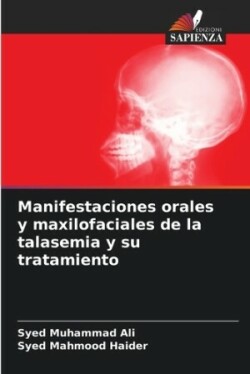 Manifestaciones orales y maxilofaciales de la talasemia y su tratamiento