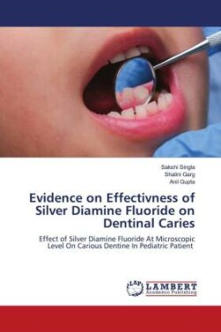 Evidence on Effectivness of Silver Diamine Fluoride on Dentinal Caries