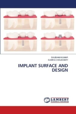 Implant Surface and Design