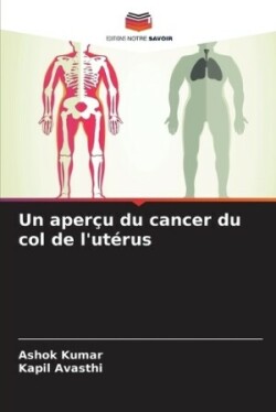 aper�u du cancer du col de l'ut�rus