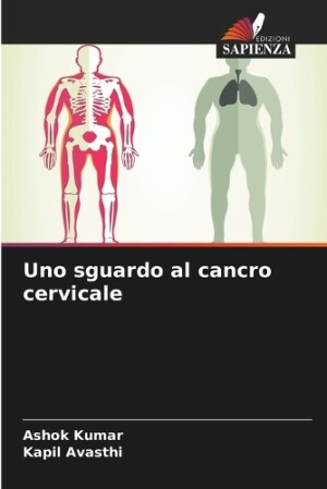 Uno sguardo al cancro cervicale