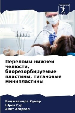 Переломы нижней челюсти, биорезорбируемы