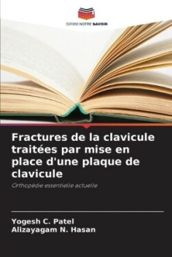 Fractures de la clavicule traitées par mise en place d'une plaque de clavicule