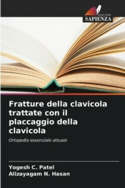 Fratture della clavicola trattate con il placcaggio della clavicola