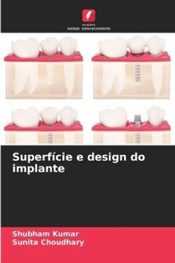 Superfície e design do implante