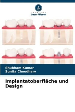 Implantatoberfläche und Design