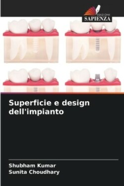 Superficie e design dell'impianto