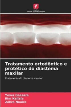 Tratamento ortodôntico e protético do diastema maxilar