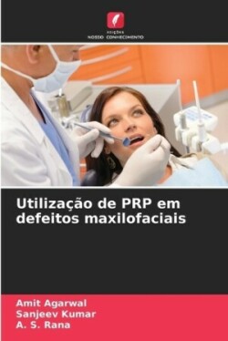 Utilização de PRP em defeitos maxilofaciais