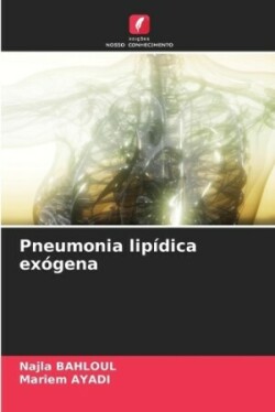 Pneumonia lipídica exógena