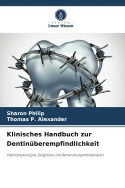 Klinisches Handbuch zur Dentinüberempfindlichkeit