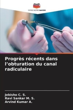 Progrès récents dans l'obturation du canal radiculaire