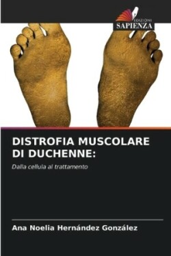 Distrofia Muscolare Di Duchenne