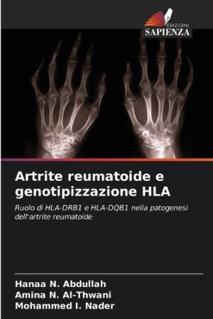 Artrite reumatoide e genotipizzazione HLA