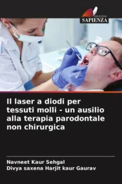 laser a diodi per tessuti molli - un ausilio alla terapia parodontale non chirurgica