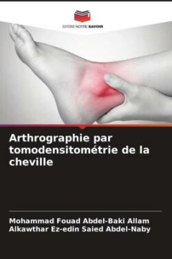 Arthrographie par tomodensitométrie de la cheville