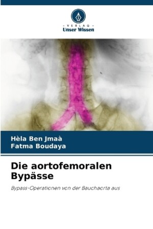 aortofemoralen Bypässe