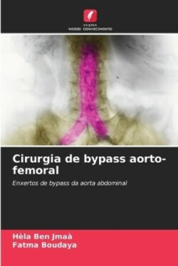 Cirurgia de bypass aorto-femoral