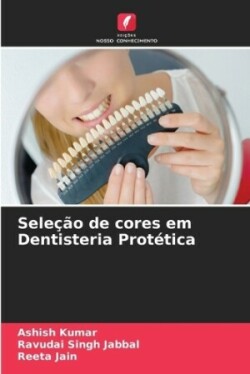 Seleção de cores em Dentisteria Protética