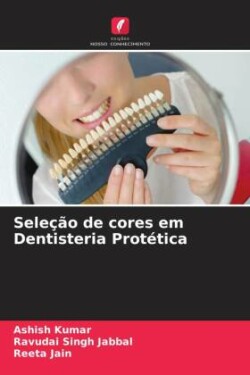 Seleção de cores em Dentisteria Protética