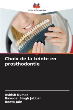 Choix de la teinte en prosthodontie