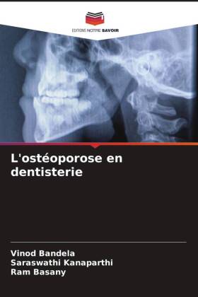 L'ostéoporose en dentisterie