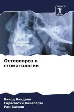 Osteoporoz w stomatologii