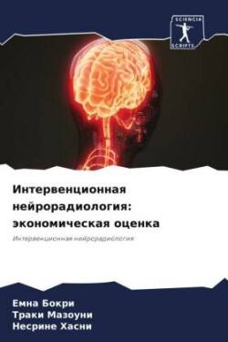 Interwencionnaq nejroradiologiq: äkonomicheskaq ocenka