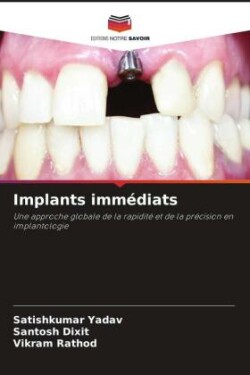 Implants immédiats