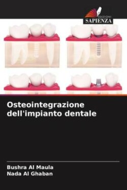 Osteointegrazione dell'impianto dentale