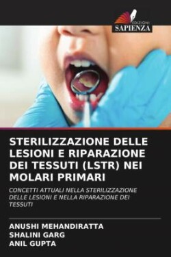 Sterilizzazione Delle Lesioni E Riparazione Dei Tessuti (Lstr) Nei Molari Primari