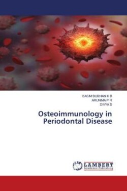 Osteoimmunology in Periodontal Disease