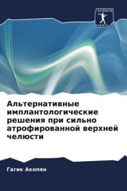 Al'ternatiwnye implantologicheskie resheniq pri sil'no atrofirowannoj werhnej chelüsti