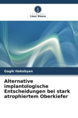 Alternative implantologische Entscheidungen bei stark atrophiertem Oberkiefer