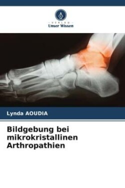 Bildgebung bei mikrokristallinen Arthropathien