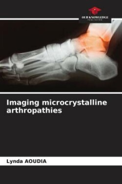 Imaging microcrystalline arthropathies