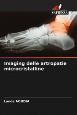 Imaging delle artropatie microcristalline