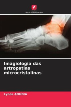 Imagiologia das artropatias microcristalinas