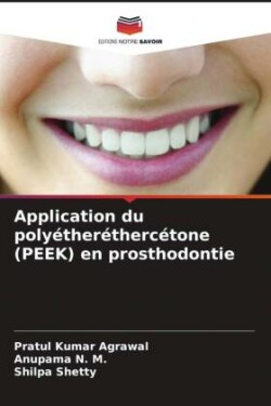 Application du polyétheréthercétone (PEEK) en prosthodontie