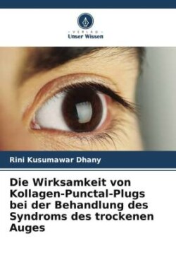 Wirksamkeit von Kollagen-Punctal-Plugs bei der Behandlung des Syndroms des trockenen Auges