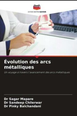 Évolution des arcs métalliques