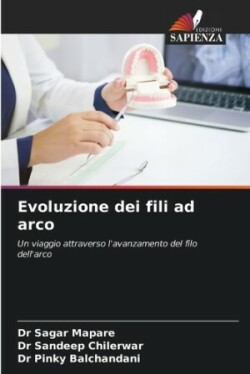 Evoluzione dei fili ad arco