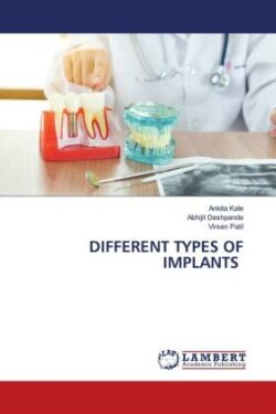 Different Types of Implants