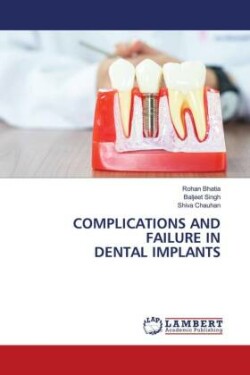 Complications and Failure in Dental Implants