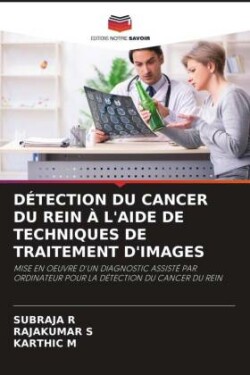 Détection Du Cancer Du Rein À l'Aide de Techniques de Traitement d'Images