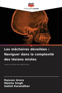 Les mâchoires dévoilées