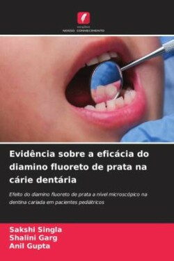 Evidência sobre a eficácia do diamino fluoreto de prata na cárie dentária