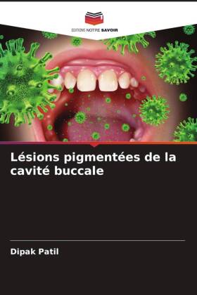 Lésions pigmentées de la cavité buccale