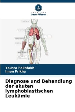 Diagnose und Behandlung der akuten lymphoblastischen Leukämie